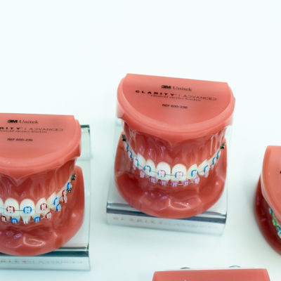 Kanning-Orthodontics-Clarity-Advanced-Clear-Braces-19-of-24-400x400 3M Clarity Advanced Clear Braces  - Braces and Invisalign in Liberty, Missouri - Kanning Orthodontics