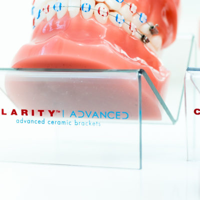 Kanning-Orthodontics-Clarity-Advanced-Clear-Braces-5-of-24-400x400 3M Clarity Advanced Clear Braces  - Braces and Invisalign in Liberty, Missouri - Kanning Orthodontics