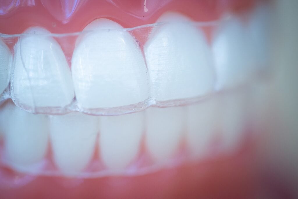 Tech-Typodonts-Kanning-Orthodontics-2020-Kansas-City-Missouri-Orthodontist-59-1024x683 Treatment for Me: Clear Aligners like Invisalign vs Braces?  - Braces and Invisalign in Liberty, Missouri - Kanning Orthodontics